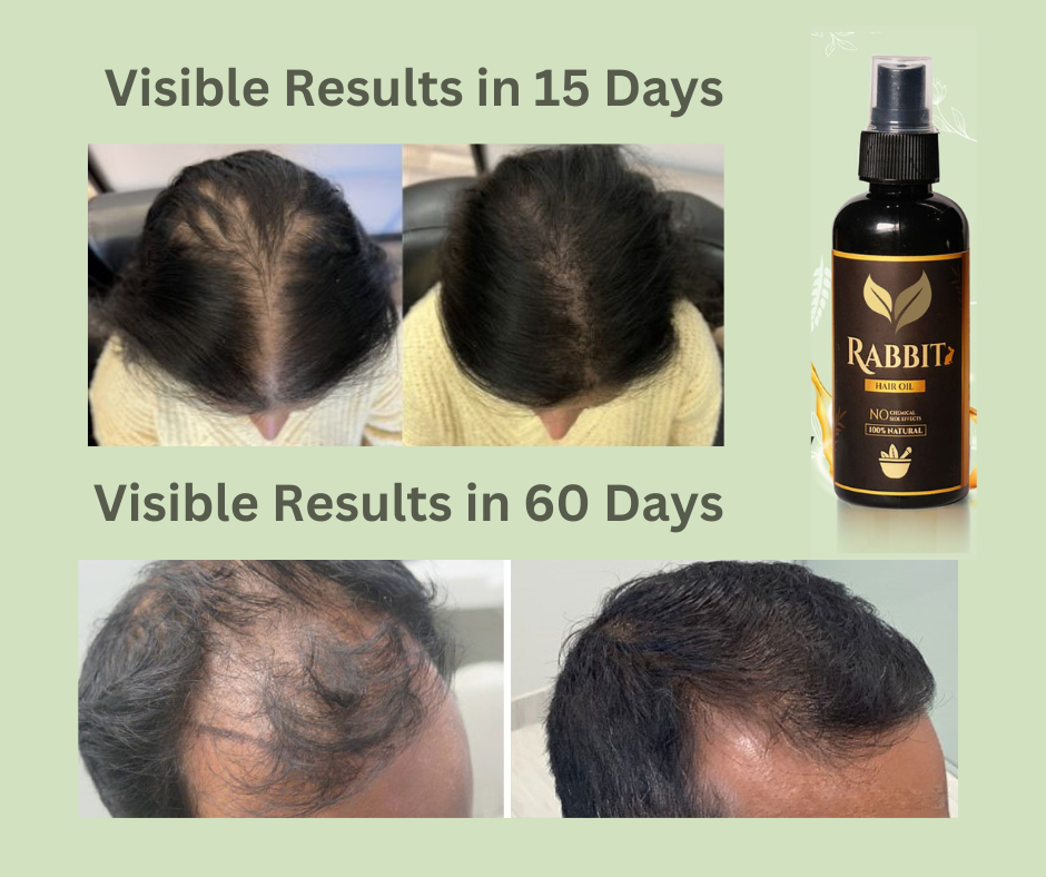 Rabbit Hair Growth Oil (Pack of 2) 🔥 BUY 1 GET 1 FREE 🔥 SALE 50% OFF🔥